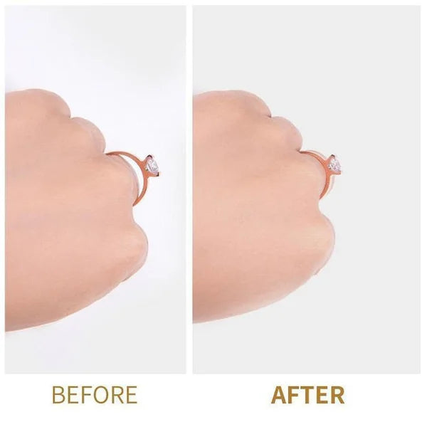 💍 مجموعة إعادة تحجيم الخواتم